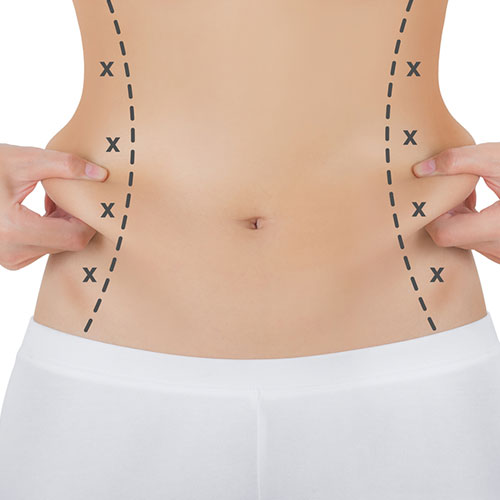 sculping body services